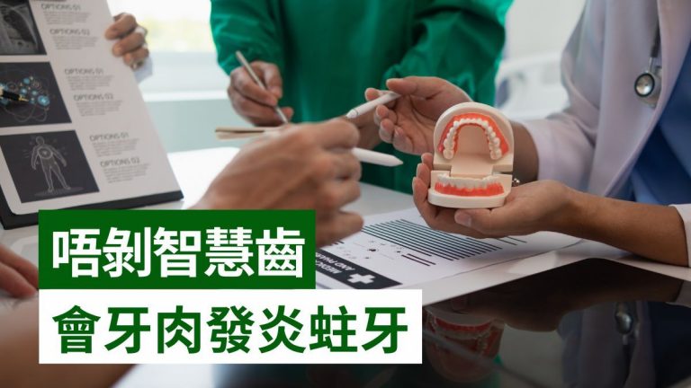 剝智慧齒價錢幾多?邊度平?會引發蛀牙/牙肉發炎/面癱?